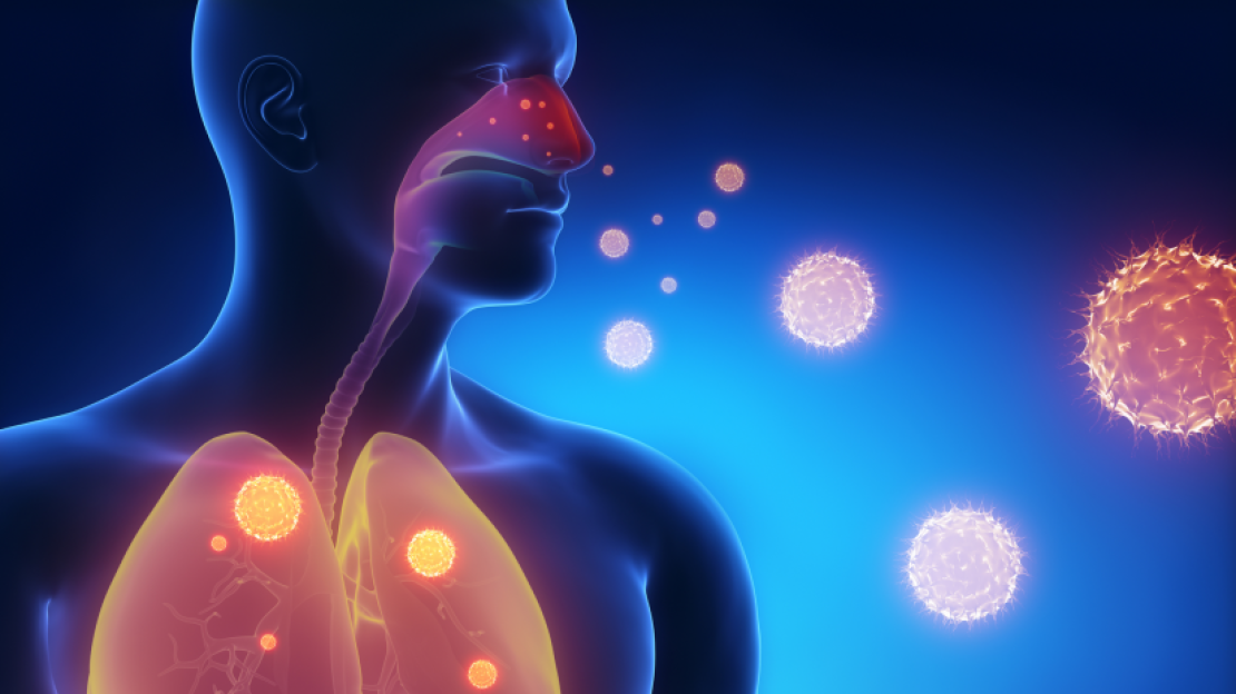 Mit kell tudni a legionárius betegségről?